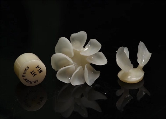 Durablity CAD-CAM Dental Composite Veneers Highly Detailed Accurate