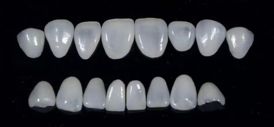 Durablity CAD-CAM Dental Composite Veneers Highly Detailed Accurate