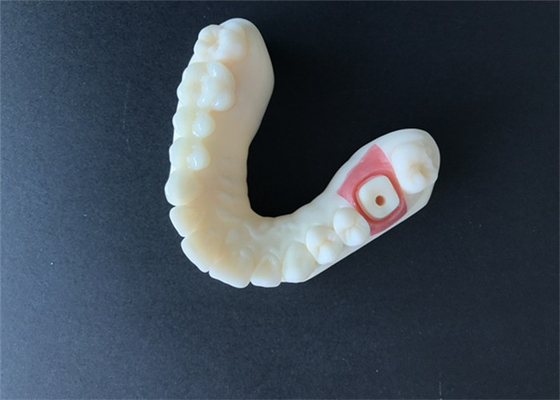 High Stability PFM Zirconia Crown Tooth Stain Resistant For Research