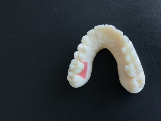 High Stability PFM Zirconia Crown Tooth Stain Resistant For Research