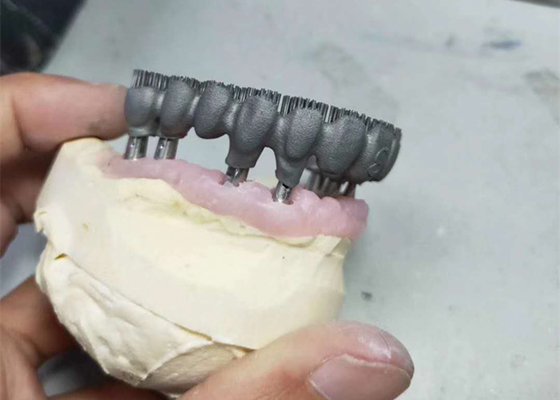Durable CAD CAM PFM 3D Printer Dental Lab Prints For Research