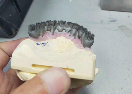 Durable CAD CAM PFM 3D Printer Dental Lab Prints For Research