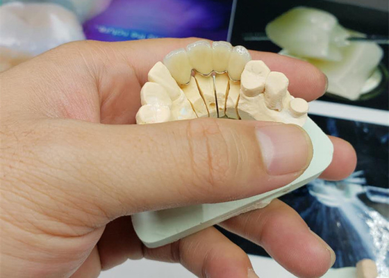 Safety Corrosion Resistant OEM Porcelain Crown All Ceramic Natural Look