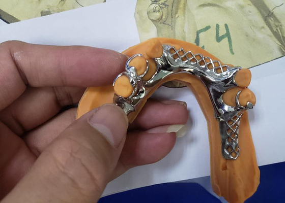 3D Printing Removable Dental Crown Framework Models For Dentistry