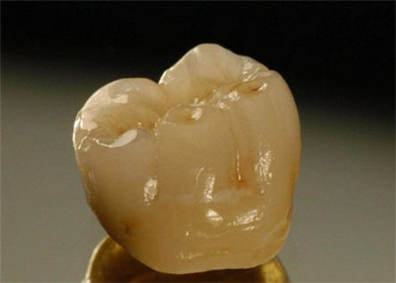 Inter Miscibility Porcelain Dental Crown