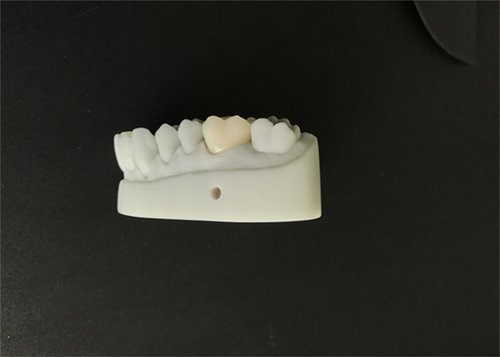 OEM 3D Printed Dental Models CAD CAM Design For Denture Laboratory