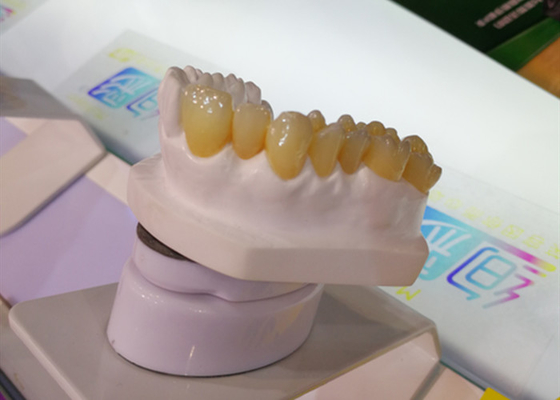 CAD CAM Design PFM Dental Crown Laboratory 3D Printer Dental Crowns