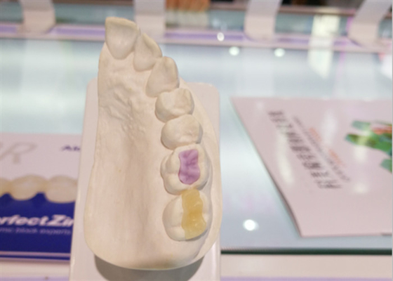 Custom High-Density Custom Dental Ceramics FDA All-Ceramic Crown