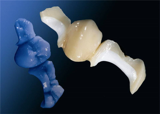 Customized OEM Polishing All-Ceramic Dental Crown Veneer Inlay Onlay