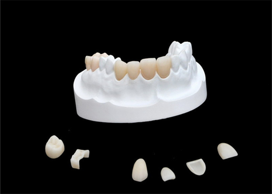 IPS E Max Ceramic Dental Crown Comfortable Porcelain Composite Veneers