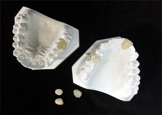Easy Maintain OEM White Ceramic Dental Crown Veneer Inlay Onlay