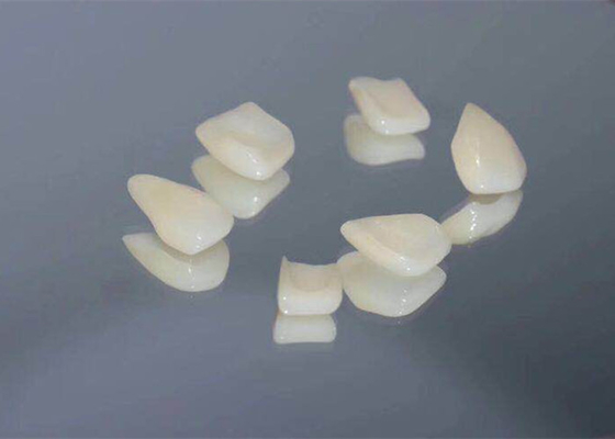Easy Clean OEM Composite Teeth Veneers Long-Lasting Color Stability