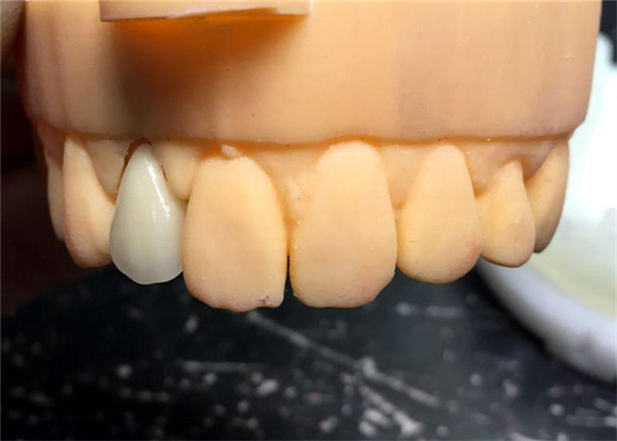 Chromecast Safety PFM Dental Crown Bridge Good Biocompatibility