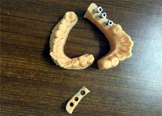 FDA 3D Printed Dental Models Dental Crown Porcelain Fused To Metal