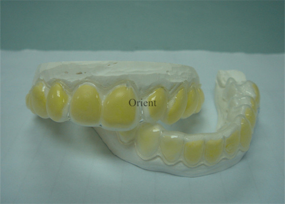 FDA Orthodontic Appliances Are Corrosion Resistant And Durable