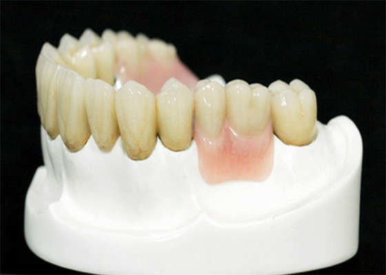 MK1 Precision Attachment Denture for Perfect Fit and Protection
