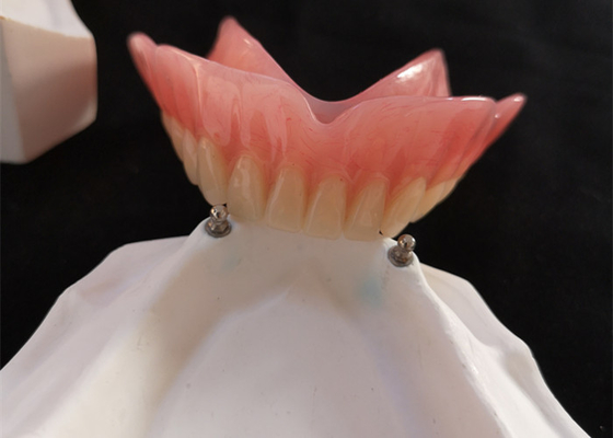 High Biocompatibility Precision Attachment Denture CAD-CAM Implant