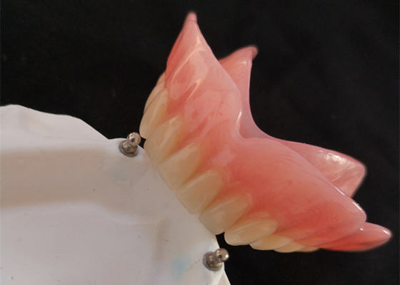 High Biocompatibility Precision Attachment Denture CAD-CAM Implant