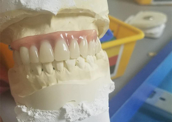 Flexible Durable Precision Attachment Denture Corrosion Resistant
