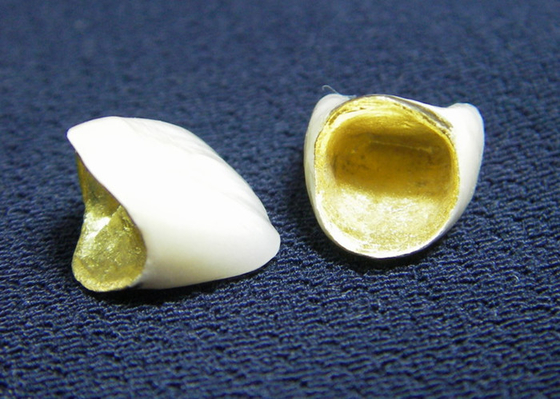 Strong Cosmetic PFM Porcelain Fused Metal Crown Colour Stability