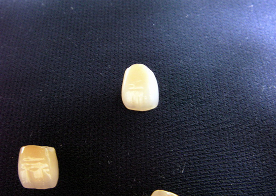Strong Cosmetic PFM Porcelain Fused Metal Crown Colour Stability