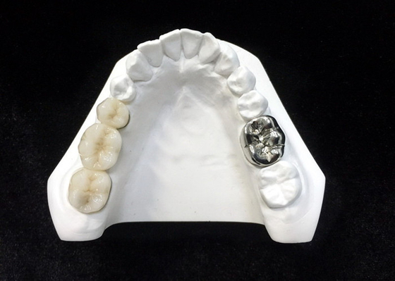 Ultra Hard Digital Porcelain Dental Crown Health Safety High Density