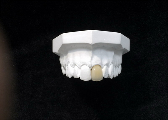 Good Biocompatibility Porcelain Dental Crown High Tech Biological Material