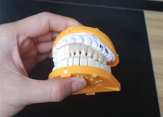 Custom Size PFM Ceramic Crowns For Posterior And Anterior Teeth