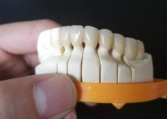 Custom Size PFM Ceramic Crowns For Posterior And Anterior Teeth