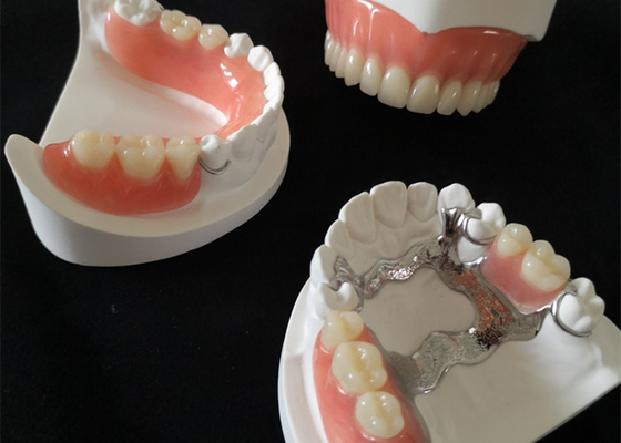 Custom Smooth Surface CAD CAM PFM Crown Bridge High Definition