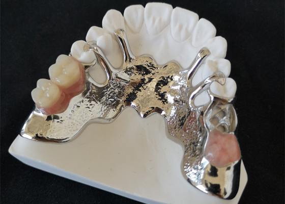 OEM 3D Printer PFM Dental Crowns Bridge High Biological Intermiscibility