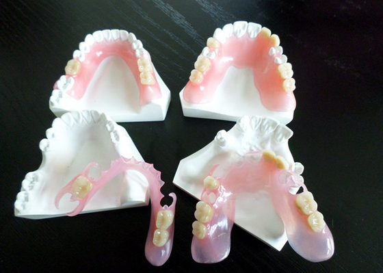 Digital PFM Dental Crown Restoration