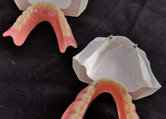 Comfortable CAD CAM Dental Implant Overdenture Easy Maintain