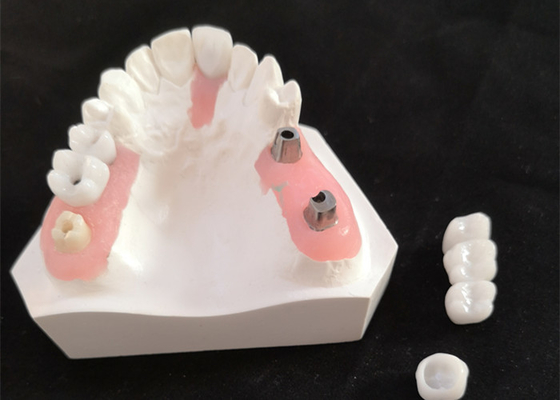 FDA All Zirconia Crown with Implant-Supported Dentures for Dental Lab