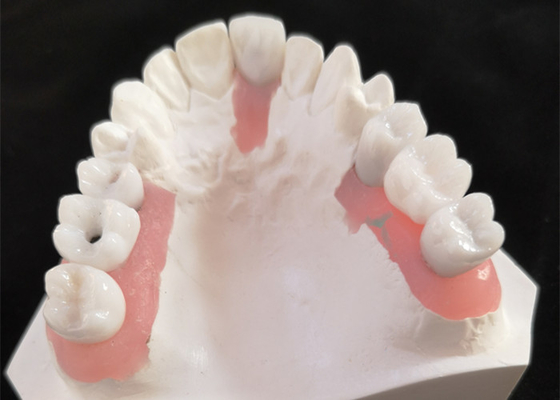 FDA All Zirconia Crown with Implant-Supported Dentures for Dental Lab