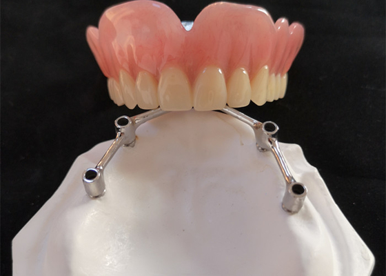 COCR Tooth Implant Crown FDA Dental Implants With Titanium Bar