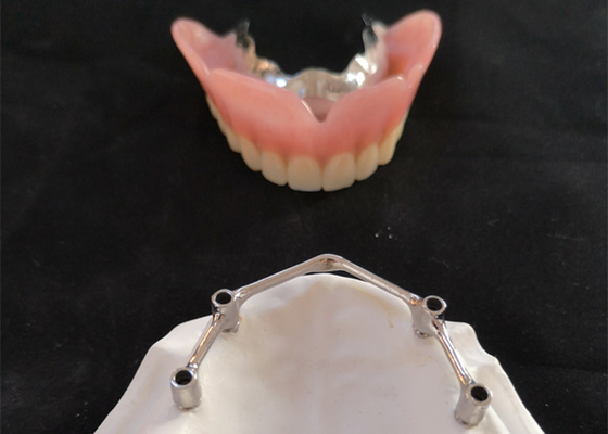 COCR Tooth Implant Crown FDA Dental Implants With Titanium Bar