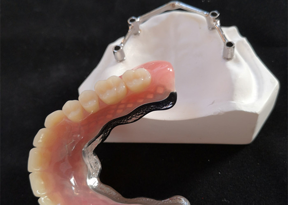 Titanium/Pure Titanium Dental Implant Bar for CAD CAM Digital Center