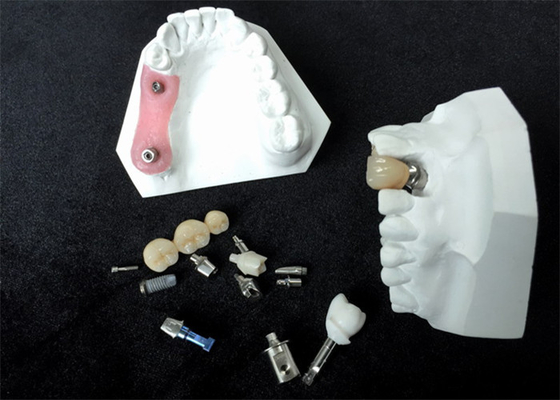 Custom Dental Implant Locators High Stability Bar Attachment Denture