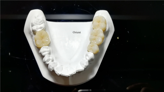 Ceramic Dental Crown,Zirconia Dental Crowns