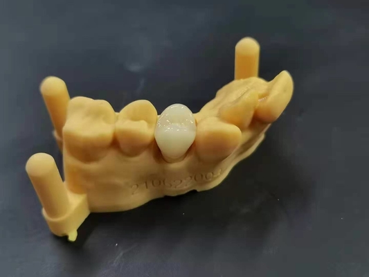 OEM 3D Printing Flexible Acrylic Denture Dental lab Digital Design