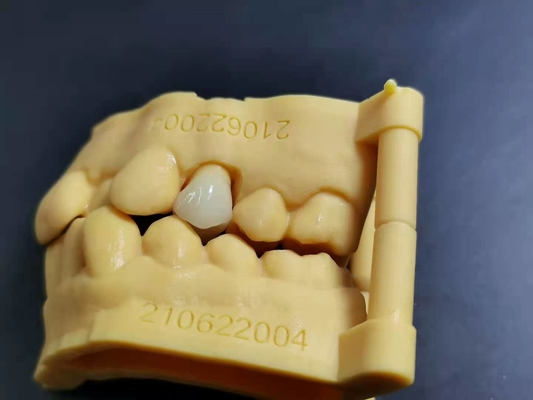 OEM 3D Printing Flexible Acrylic Denture Dental lab Digital Design