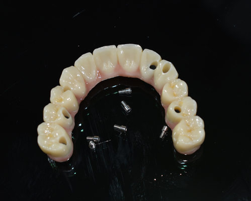 Zirconia Dental Crown: Natural-looking Teeth, Durable &amp; Secure
