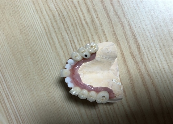 Accurate Biocompatibility Dental Implant Attachments Tooth Implant Crown