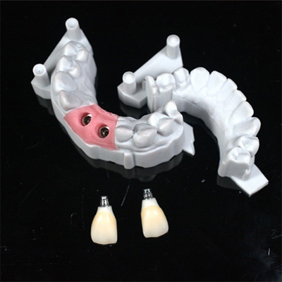 Precise CAD/CAM Design Zirconia Dental Crown for Fitment