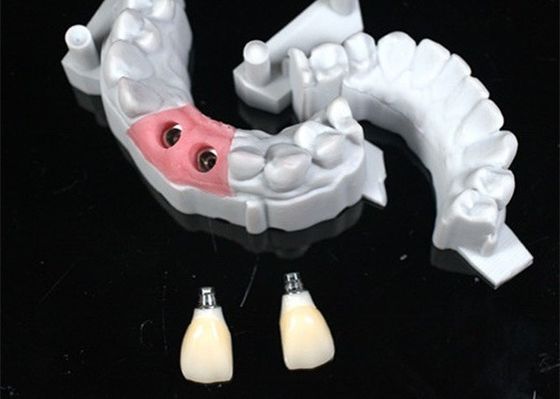 Natural-looking Zirconia Dental Crown with Excellent Biocompatibility and Cementable 3D Model