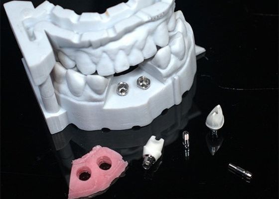 Natural-looking Zirconia Dental Crown with Excellent Biocompatibility and Cementable 3D Model
