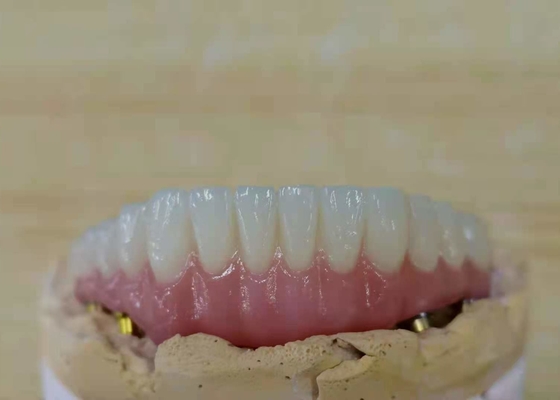 FDA All Zirconia Crown with Implant-Supported Dentures for Dental Lab