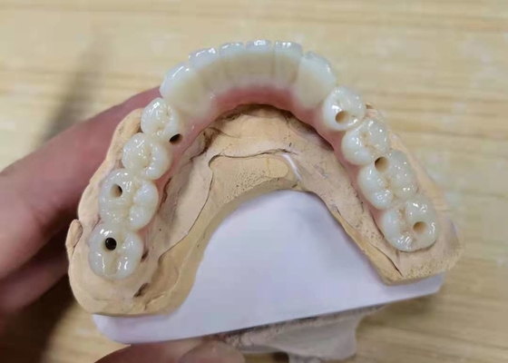 FDA All Zirconia Crown with Implant-Supported Dentures for Dental Lab