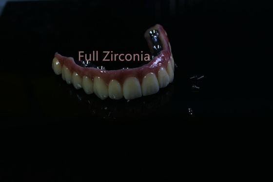 Health Safety CAD CAM Dental Implant Bar High Tech Biological Material